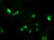 ALX Homeobox 4 antibody, LS-C174200, Lifespan Biosciences, Immunofluorescence image 
