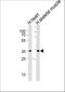 Iodothyronine Deiodinase 2 antibody, A02249-1, Boster Biological Technology, Western Blot image 