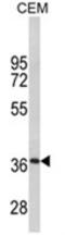 Myelin Protein Zero antibody, AP18120PU-N, Origene, Western Blot image 