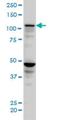 SEC24 Homolog D, COPII Coat Complex Component antibody, H00009871-M04, Novus Biologicals, Western Blot image 