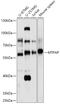 Poly(A) RNA polymerase, mitochondrial antibody, 18-065, ProSci, Western Blot image 