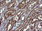 Serpin Family B Member 3 antibody, LS-C797756, Lifespan Biosciences, Immunohistochemistry frozen image 