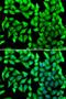 Vesicle Transport Through Interaction With T-SNAREs 1B antibody, LS-C346211, Lifespan Biosciences, Immunofluorescence image 