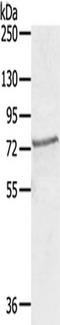 SKI Like Proto-Oncogene antibody, TA350435, Origene, Western Blot image 