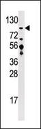 Ubiquitin Specific Peptidase 33 antibody, AP12074PU-N, Origene, Western Blot image 