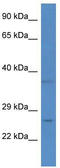 Coiled-Coil-Helix-Coiled-Coil-Helix Domain Containing 6 antibody, TA342947, Origene, Western Blot image 