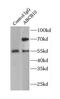 ATP Binding Cassette Subfamily B Member 10 antibody, FNab00030, FineTest, Immunoprecipitation image 