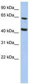 Mitochondrial Calcium Uptake Family Member 3 antibody, TA333407, Origene, Western Blot image 
