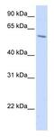 Porcupine O-Acyltransferase antibody, ab105543, Abcam, Western Blot image 