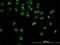 Cleavage And Polyadenylation Specific Factor 3 antibody, H00051692-M01, Novus Biologicals, Immunofluorescence image 