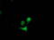 Destrin antibody, M03849, Boster Biological Technology, Immunofluorescence image 