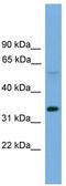Dendrocyte Expressed Seven Transmembrane Protein antibody, TA339561, Origene, Western Blot image 