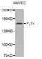 Fms Related Tyrosine Kinase 4 antibody, TA332783, Origene, Western Blot image 