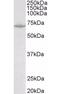 Solute Carrier Family 6 Member 8 antibody, orb12978, Biorbyt, Western Blot image 