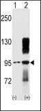 Discoidin Domain Receptor Tyrosine Kinase 2 antibody, MBS9208397, MyBioSource, Western Blot image 