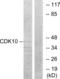 Cyclin-dependent kinase 10 antibody, abx013615, Abbexa, Western Blot image 
