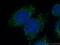 Ribosomal Protein S13 antibody, 16680-1-AP, Proteintech Group, Immunofluorescence image 