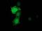 Phenylethanolamine N-Methyltransferase antibody, MA5-25531, Invitrogen Antibodies, Immunocytochemistry image 