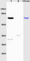 Interleukin 1 Receptor Associated Kinase 1 antibody, OABF01186, Aviva Systems Biology, Western Blot image 