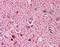 HUS1 Checkpoint Clamp Component B antibody, orb86614, Biorbyt, Immunohistochemistry paraffin image 
