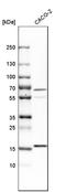 Myosin regulatory light chain 2, atrial isoform antibody, HPA013331, Atlas Antibodies, Western Blot image 