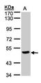Carboxypeptidase Q antibody, LS-C185536, Lifespan Biosciences, Western Blot image 