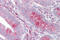 2 -5 -oligoadenylate synthase 1 antibody, ARP51359_P050, Aviva Systems Biology, Immunohistochemistry frozen image 