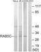 Ras-related protein Rab-5C antibody, A05148, Boster Biological Technology, Western Blot image 