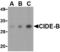 Cell Death Inducing DFFA Like Effector B antibody, TA306050, Origene, Western Blot image 