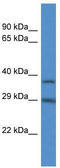 Ras-related protein Rab-34 antibody, TA342992, Origene, Western Blot image 