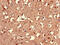 LMBR1 Domain Containing 1 antibody, CSB-PA885730LA01HU, Cusabio, Immunohistochemistry paraffin image 