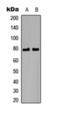 BMX Non-Receptor Tyrosine Kinase antibody, orb393225, Biorbyt, Western Blot image 