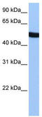 Spermatogenesis Associated 6 antibody, TA335506, Origene, Western Blot image 