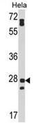Protein FAM3B antibody, AP17357PU-N, Origene, Western Blot image 
