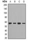 Chaperonin Containing TCP1 Subunit 2 antibody, orb377970, Biorbyt, Western Blot image 