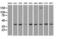 Mitogen-Activated Protein Kinase 1 antibody, GTX84154, GeneTex, Western Blot image 