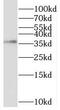 Troponin T2, Cardiac Type antibody, FNab09914, FineTest, Western Blot image 