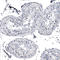 Keratin 77 antibody, HPA045934, Atlas Antibodies, Immunohistochemistry frozen image 