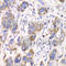 Aldehyde Dehydrogenase 2 Family Member antibody, A1226, ABclonal Technology, Immunohistochemistry paraffin image 