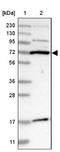 Kelch Like Family Member 6 antibody, NBP1-83880, Novus Biologicals, Western Blot image 