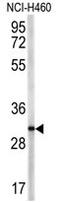 CD40 Ligand antibody, AP17806PU-N, Origene, Western Blot image 