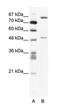 Stromelysin-2 antibody, PA1-24316, Invitrogen Antibodies, Western Blot image 