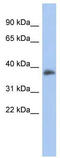Forkhead box protein B1 antibody, TA339452, Origene, Western Blot image 