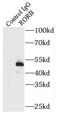 Nuclear receptor ROR-beta antibody, FNab07388, FineTest, Immunoprecipitation image 