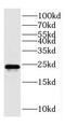 Peptidylprolyl Isomerase B antibody, FNab02136, FineTest, Western Blot image 