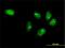 Metastasis Associated 1 Family Member 3 antibody, H00057504-M06, Novus Biologicals, Immunocytochemistry image 