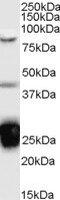 Nucleolysin TIA-1 antibody, MBS420429, MyBioSource, Western Blot image 