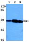 Iroquois Homeobox 1 antibody, PA5-36256, Invitrogen Antibodies, Western Blot image 