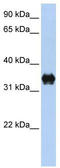 Pyrroline-5-Carboxylate Reductase 2 antibody, TA334475, Origene, Western Blot image 