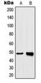 HNRNPH1 antibody, MBS821744, MyBioSource, Western Blot image 